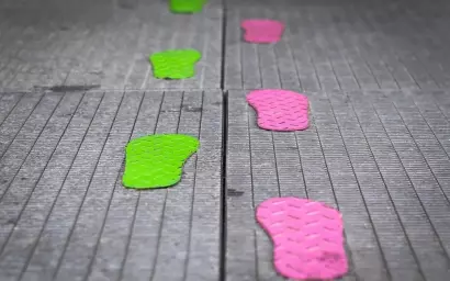 Patrones-angulares-en-rodilla